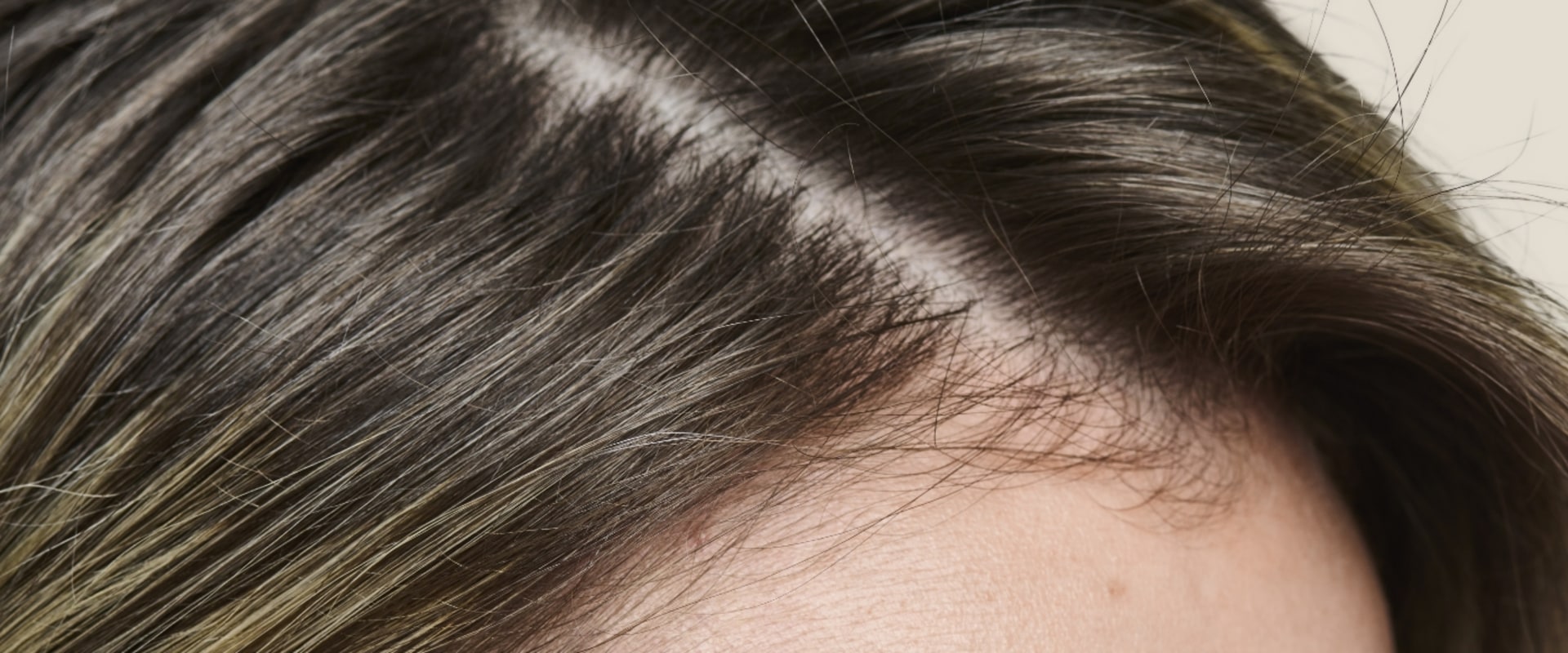 All You Need to Know About Hair Pattern and Thickness