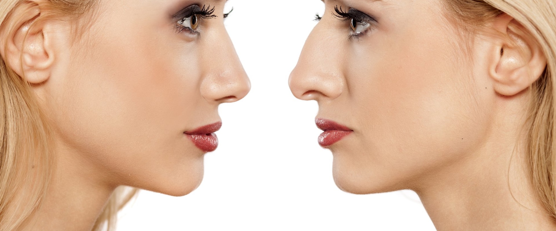 What is the easiest plastic surgery to recover from?