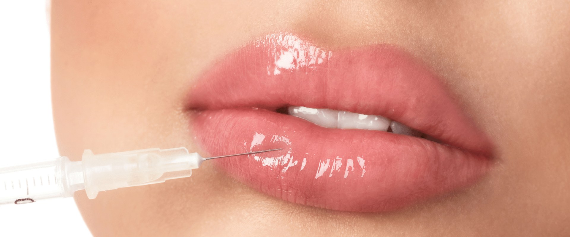 Understanding Dermal Fillers: A Comprehensive Guide for Plastic Surgery Enthusiasts