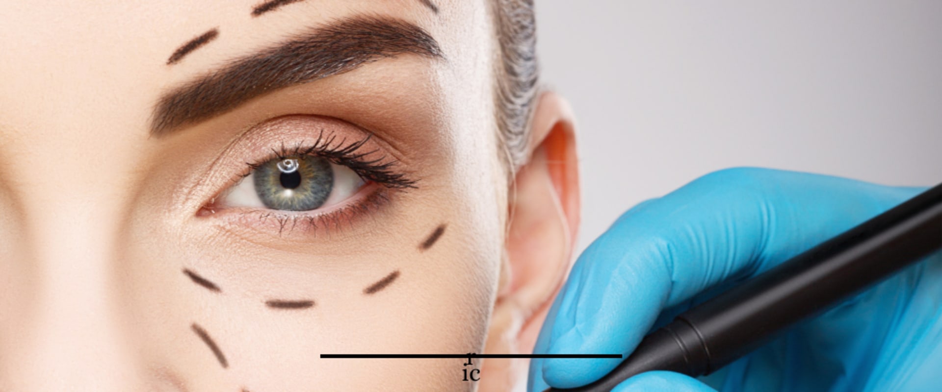 What is the most common facial plastic surgery?