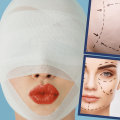 Exploring the Risks of Plastic Surgery