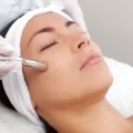 Dermabrasion: A Comprehensive Guide to Plastic Surgery Procedures for Skin Resurfacing