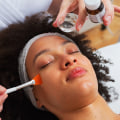 A Comprehensive Look at Chemical Peels for Skin Procedures