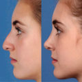 What is the classification of plastic surgery?