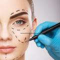 What is the most common facial plastic surgery?