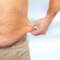 Understanding Liposuction: A Guide to Popular Plastic Surgery Procedures for Men