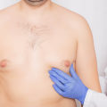 Everything You Need to Know About Male Breast Reduction