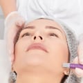 Understanding Microdermabrasion: The Complete Guide