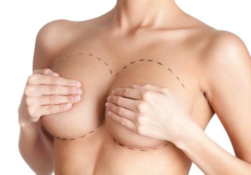 Breast Augmentation: Enhancing Your Appearance Through Plastic Surgery