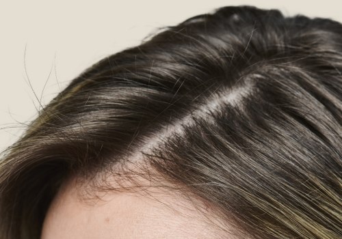 All You Need to Know About Hair Pattern and Thickness