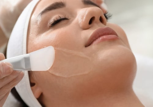 Exploring the Different Types of Chemical Peels