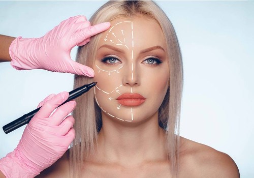 Does plastic surgery improve mental health?