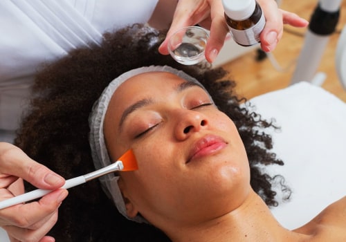 A Comprehensive Look at Chemical Peels for Skin Procedures