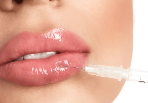 Understanding Dermal Fillers: A Comprehensive Guide for Plastic Surgery Enthusiasts