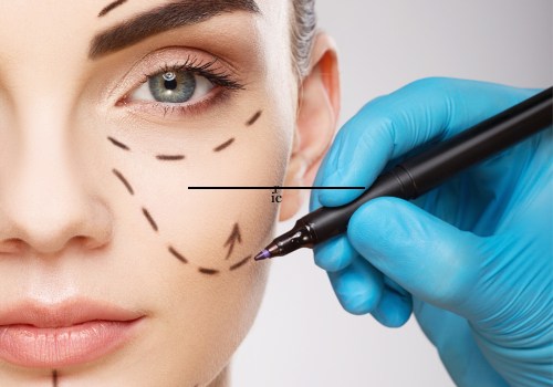 What is the most common facial plastic surgery?