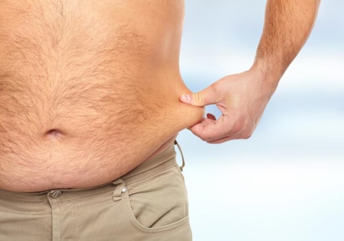 Understanding Liposuction: A Guide to Popular Plastic Surgery Procedures for Men