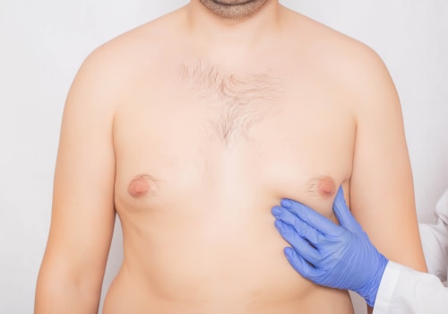 Everything You Need to Know About Male Breast Reduction