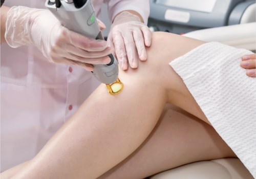 All You Need to Know About Laser Treatments